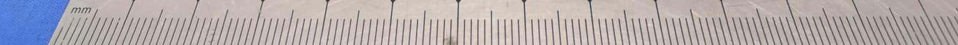 Door Phone - FCC ID 2AHCR-R20K - AKUVOX (XIAMEN) NETWORKS CO., LTD. (2)