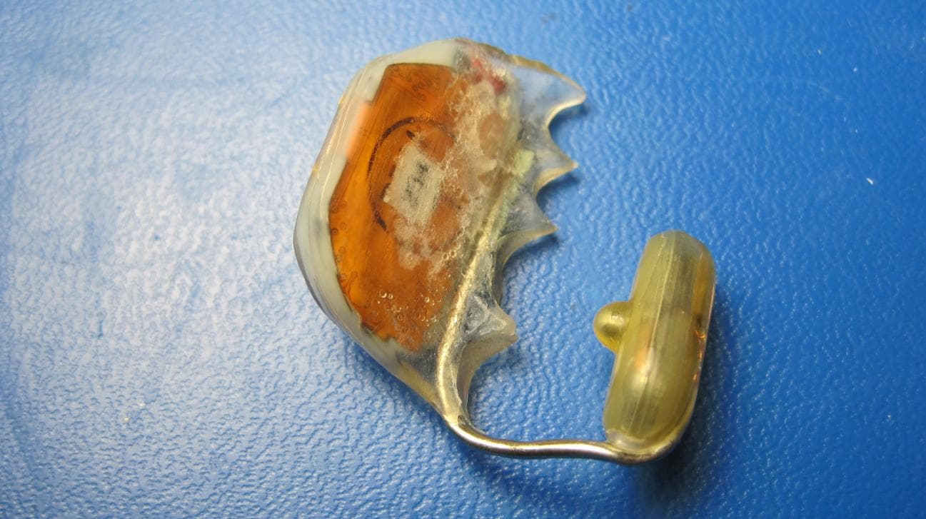 Hearing System - FCC ID YTESM03 - Sonitus Medical Inc. (1)