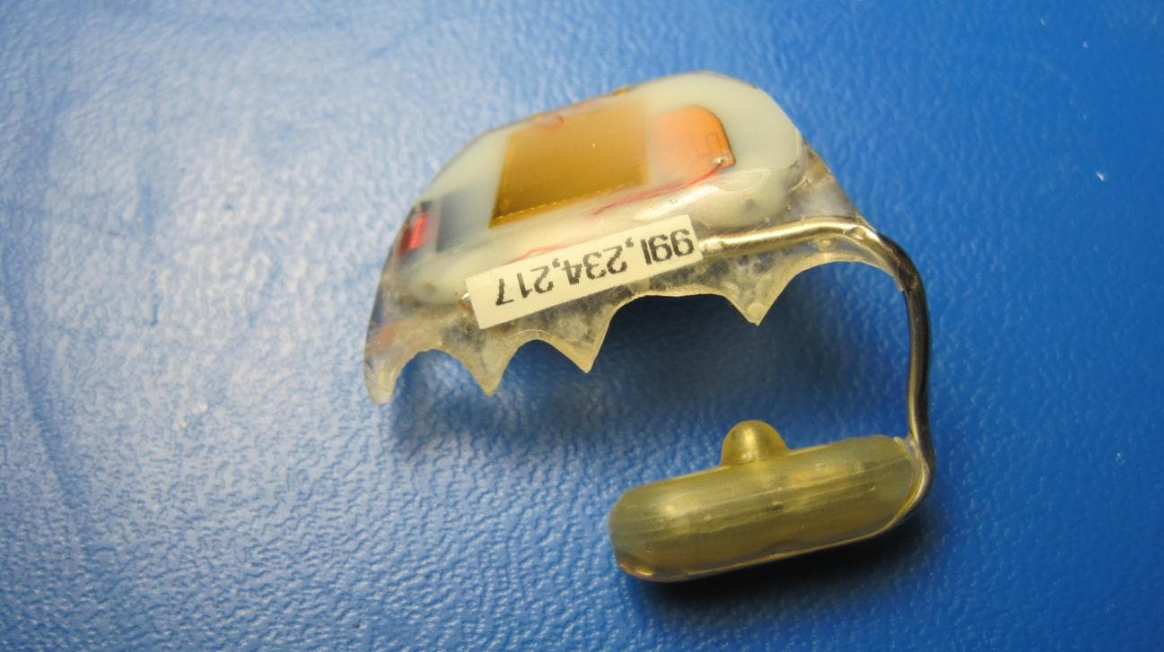 Hearing System - FCC ID YTESM03 - Sonitus Medical Inc. (4)