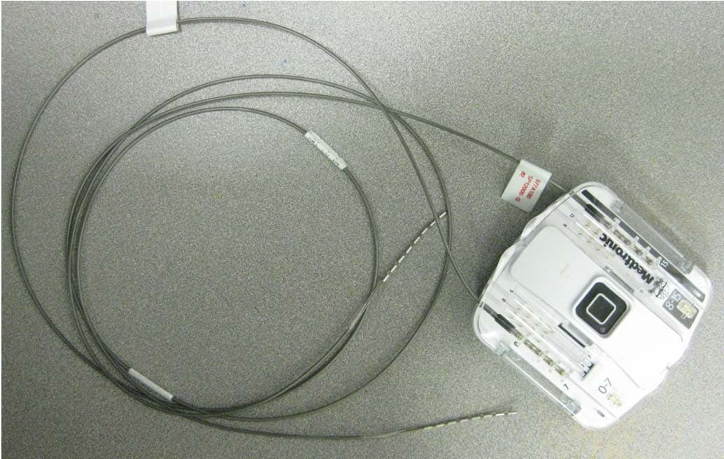 Pain ENS - Wireless External Neurostimulator - FCC ID LF597725 - Medtronic, Inc.
